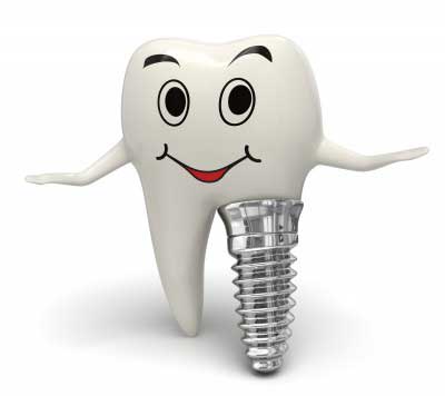 Dental Implants Cumbernauld